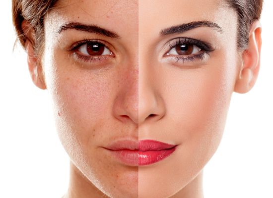 Anti-Aging Power und ein seidiges Hautbild ohne Make-up das kann BB Glow! Jetzt neu auch bei mir im Studio in Wängi!